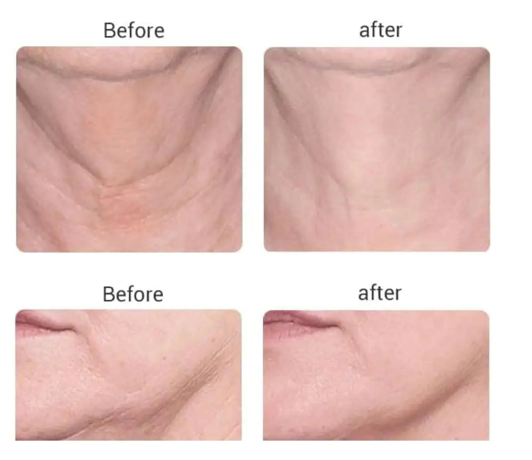 Glow & Lift Facial Massager