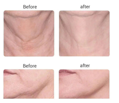Glow & Lift Facial Massager